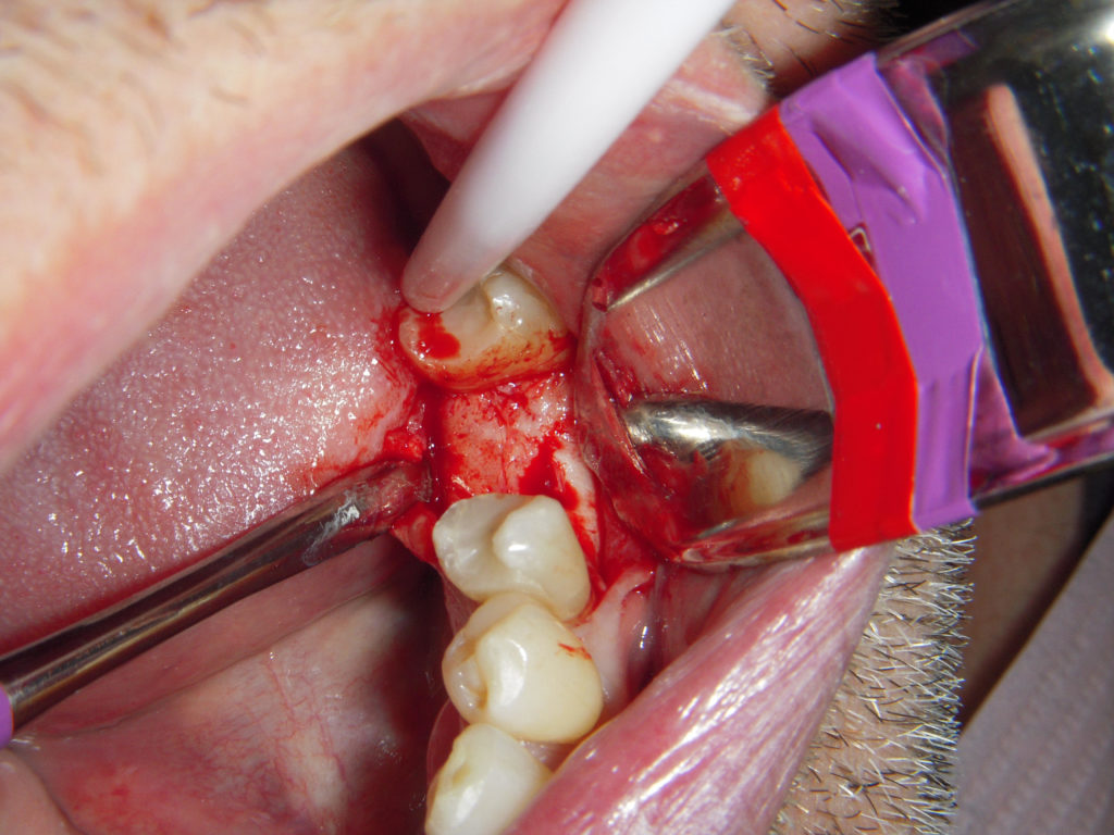 2 - I wanted to quit dentistry