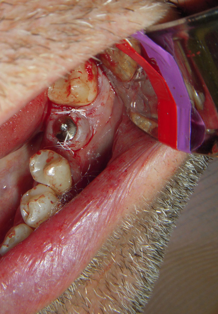 3 - I wanted to quit dentistry