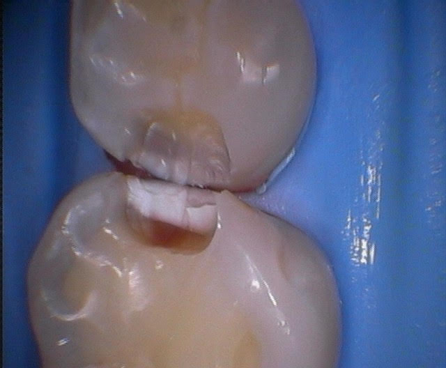 4 - I wanted to quit dentistry