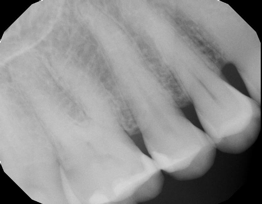 5 - I wanted to quit dentistry